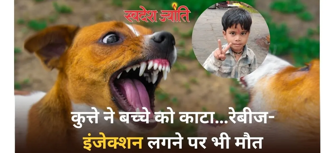  कुत्ते ने बच्चे को काटा, 25 दिन बाद वायरस दिमाग मे घुसा, एंटी रेबीज टीका लगाने के बाद भी नहींं बचा मासूम