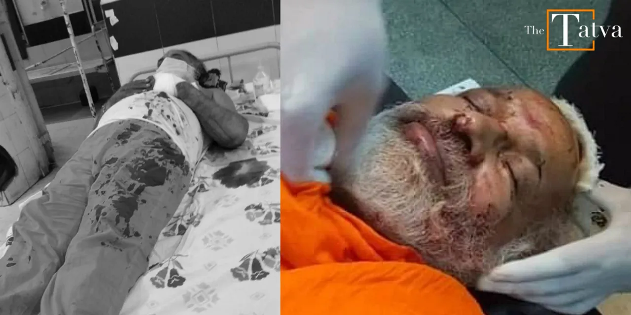  Hindu Sadhu brutally assaulted, stabbed by 'unknown miscreants' in Maharashtra's Aurangabad| WATCH