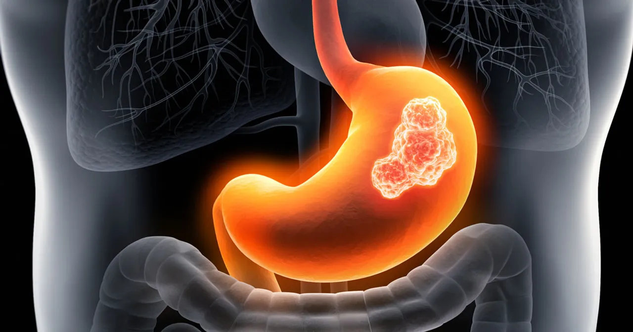  Detecting early signs of stomach cancer
