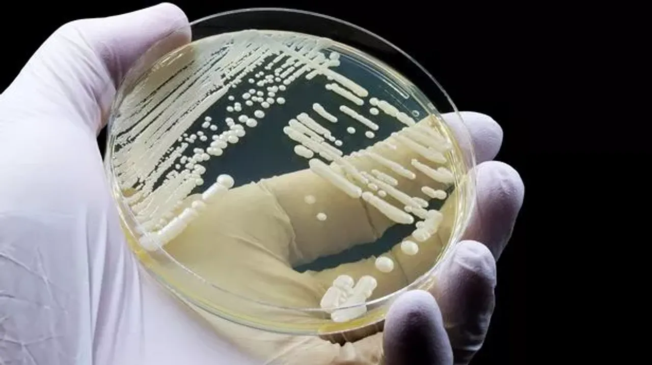  Candida Auris, a Deadly Fungal Infection, is Spreading Fast in the US