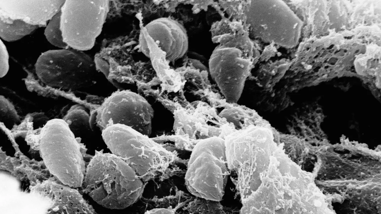  US officials confirm rare human case of bubonic plague which killed millions of people in 14th-century