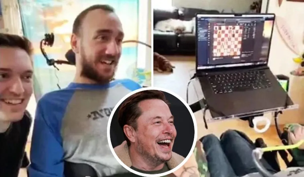  Elon Musk posts video of man with Neuralink brain chip playing chess via 'telepathy'