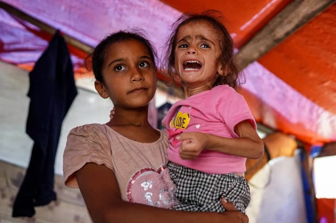  1 in 4 children under 5 faces 'severe' food poverty: UNICEF