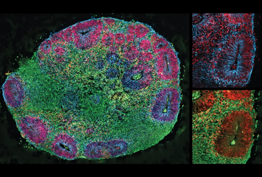  Scientists develop 'Chimeroids' using cells from multiple donors