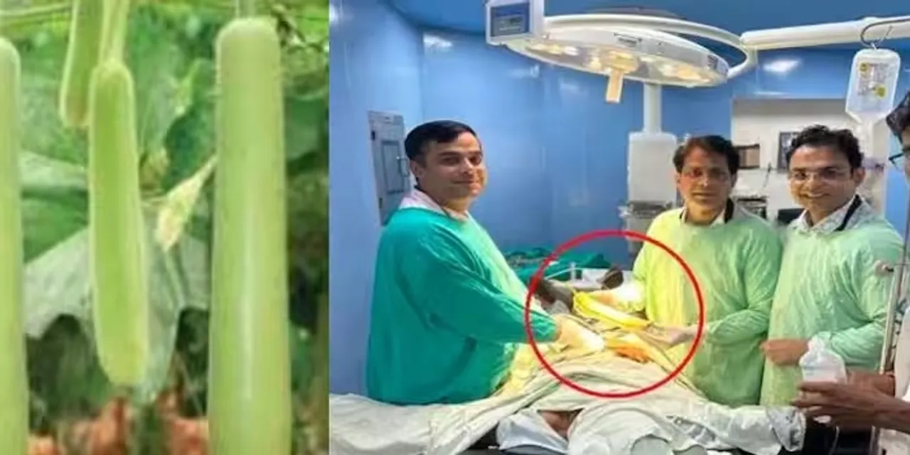  Doctors in Madhya Pradesh performed 2-hour surgery to remove Lauki from man rectum