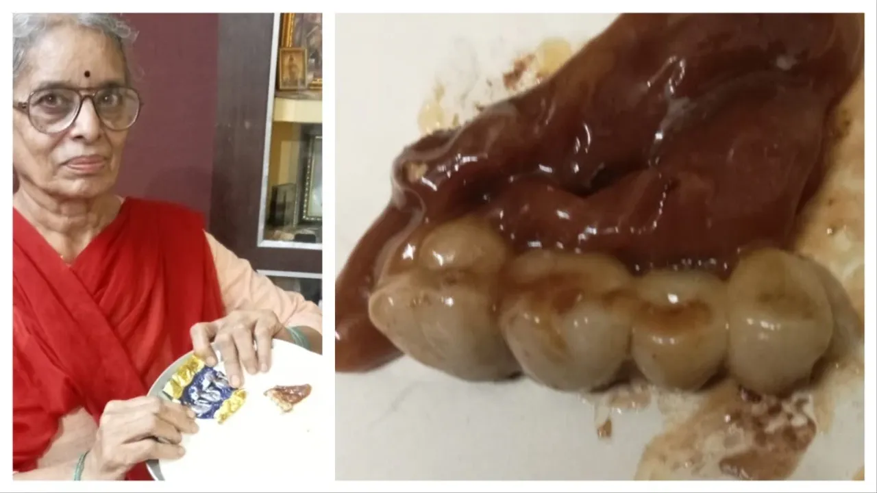  Four dentures discovered in chocolate gift at Madhya Pradesh birthday party