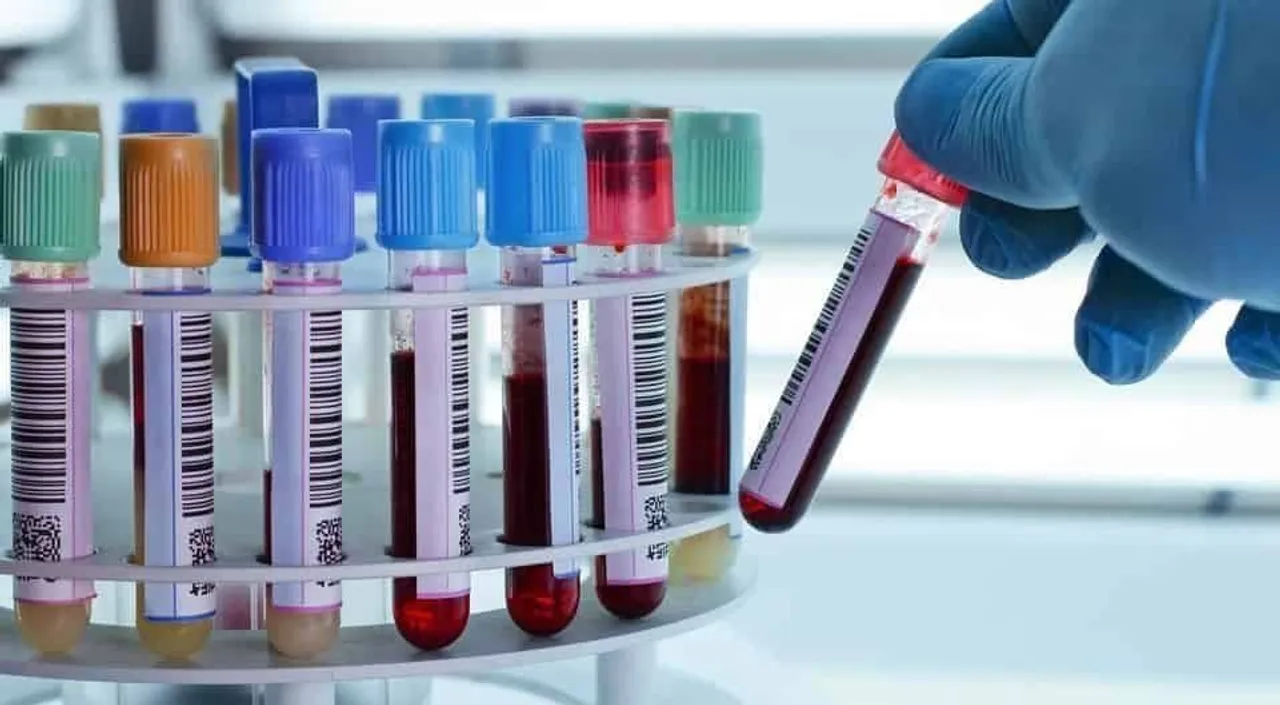  Maharashtra government plans targeting fraudulent pathology labs