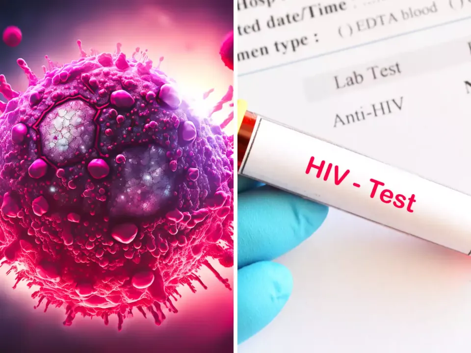 UN reports nearly 40 million people had HIV in 2023