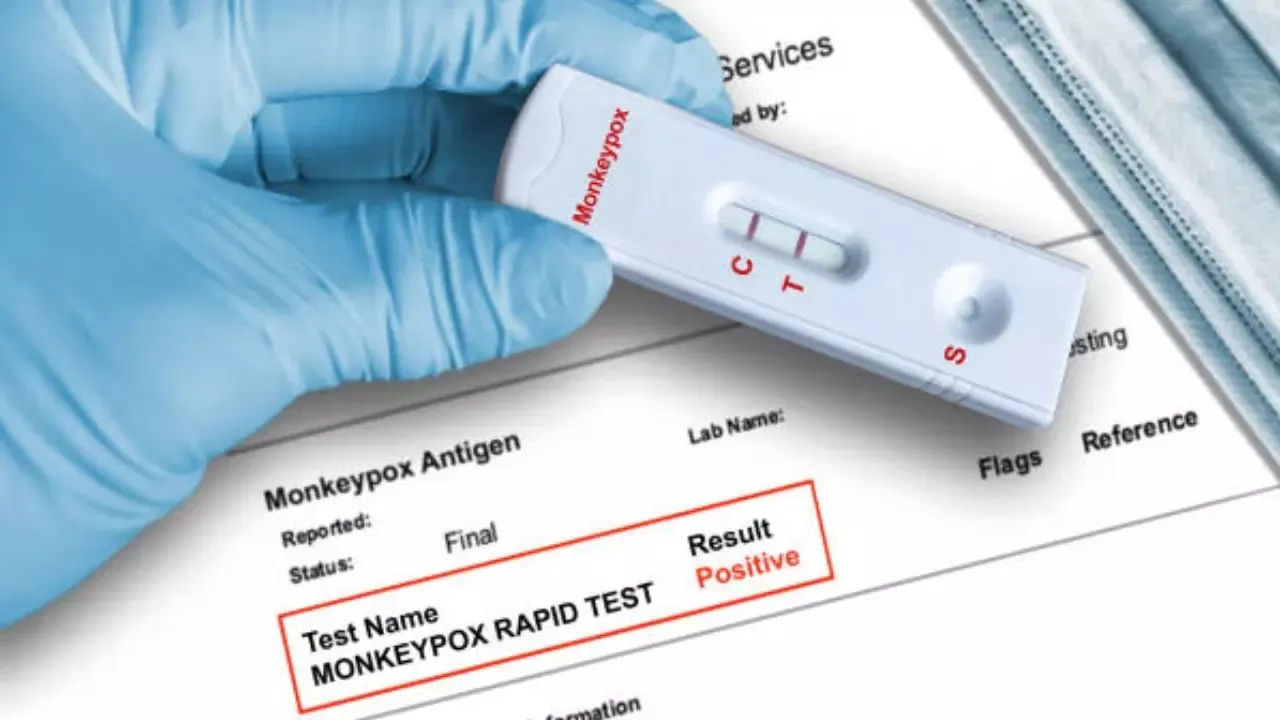 India’s indigenous Monkeypox RT-PCR testing kit receives CDSCO approval