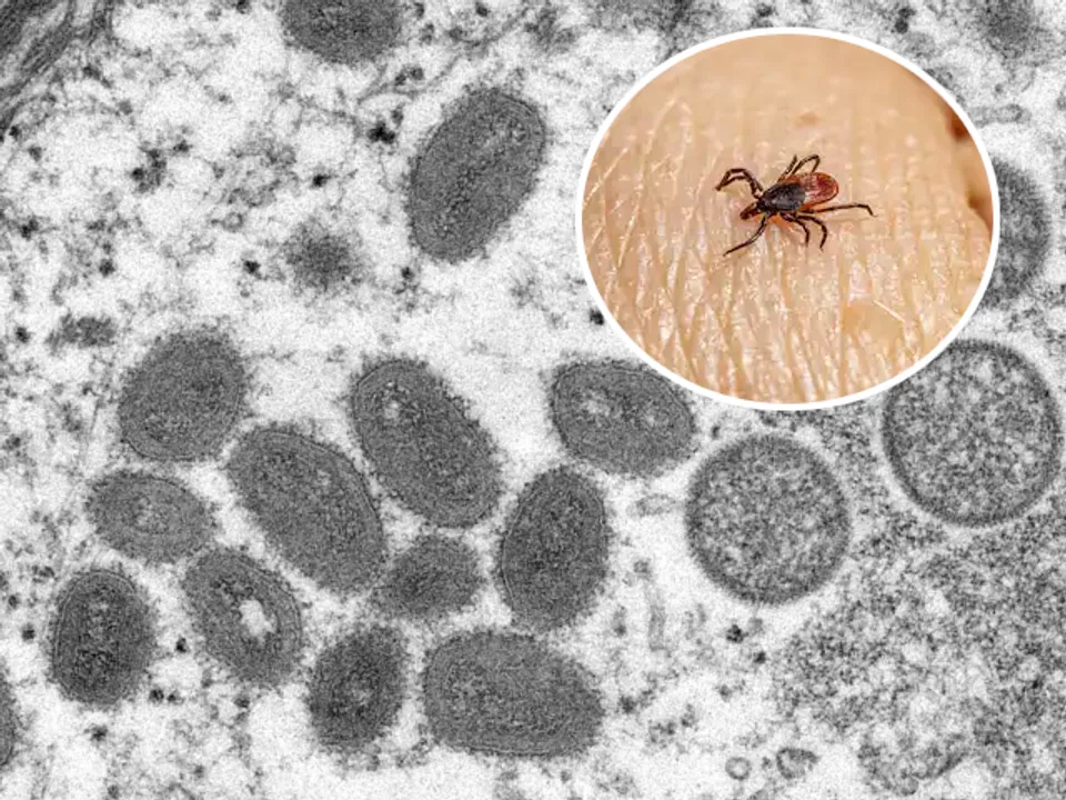  Newly discovered Wetland virus in China linked to severe neurological damage