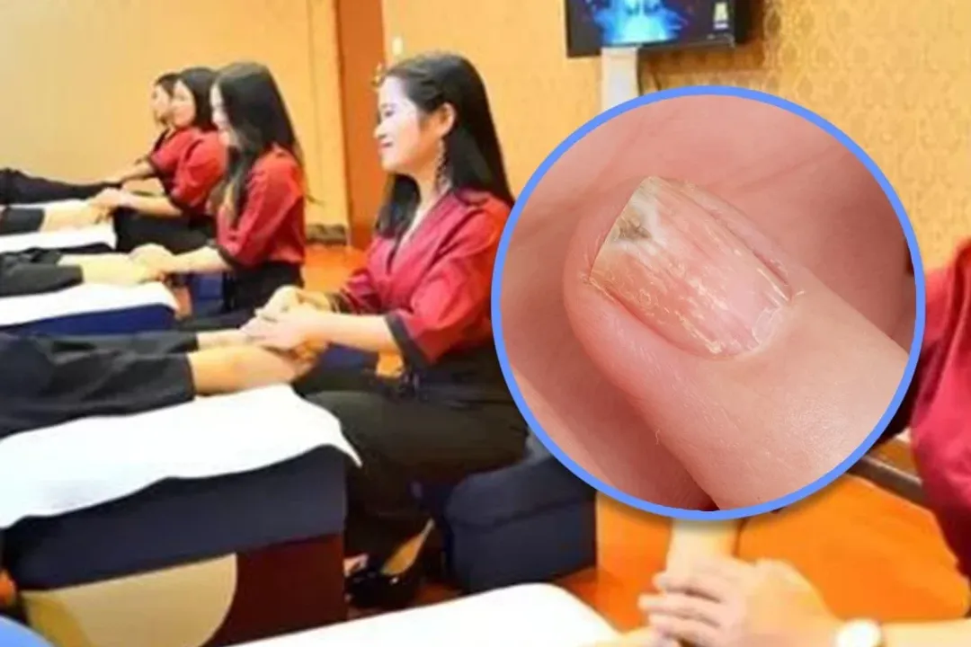  Chinese boy loses finger after foot spa treatment for nail infection goes horribly wrong