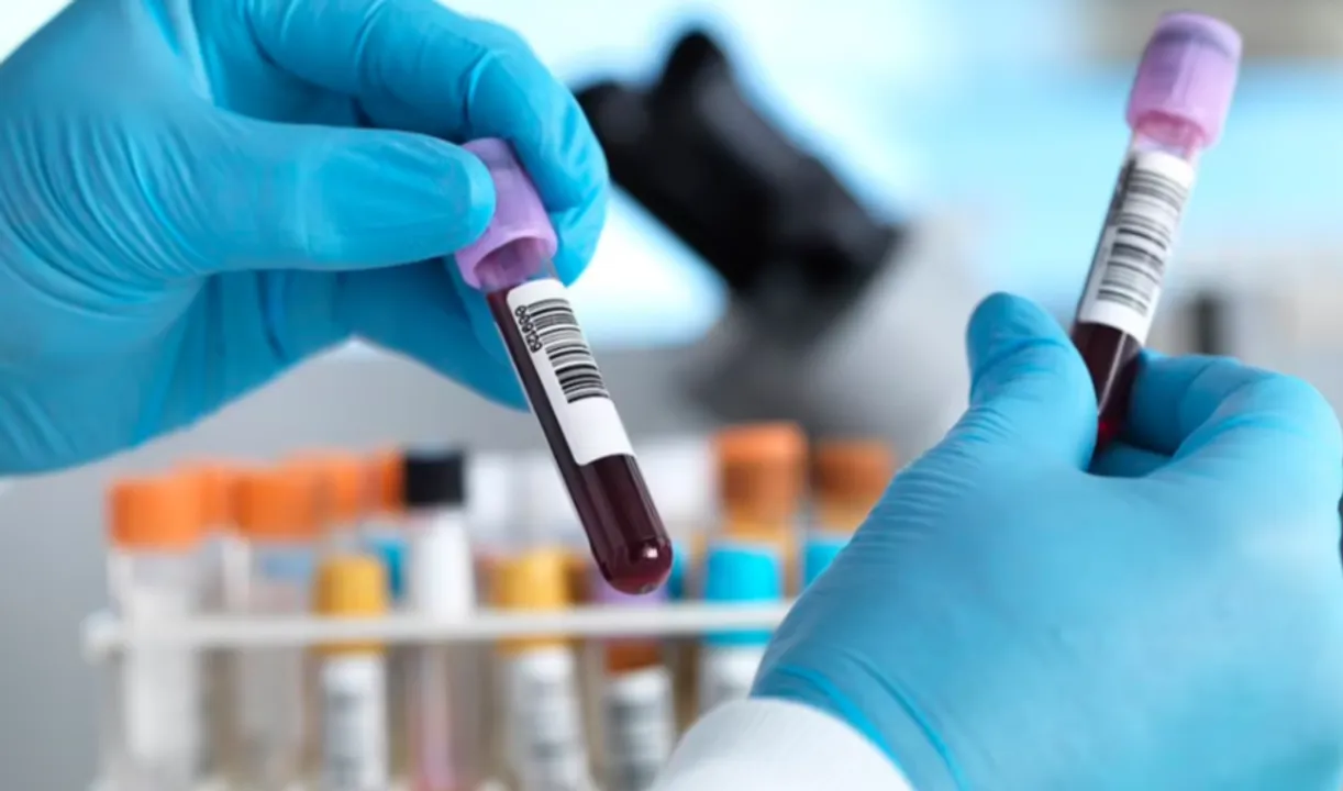  UK Government to launch revolutionary blood test for early cancer detection