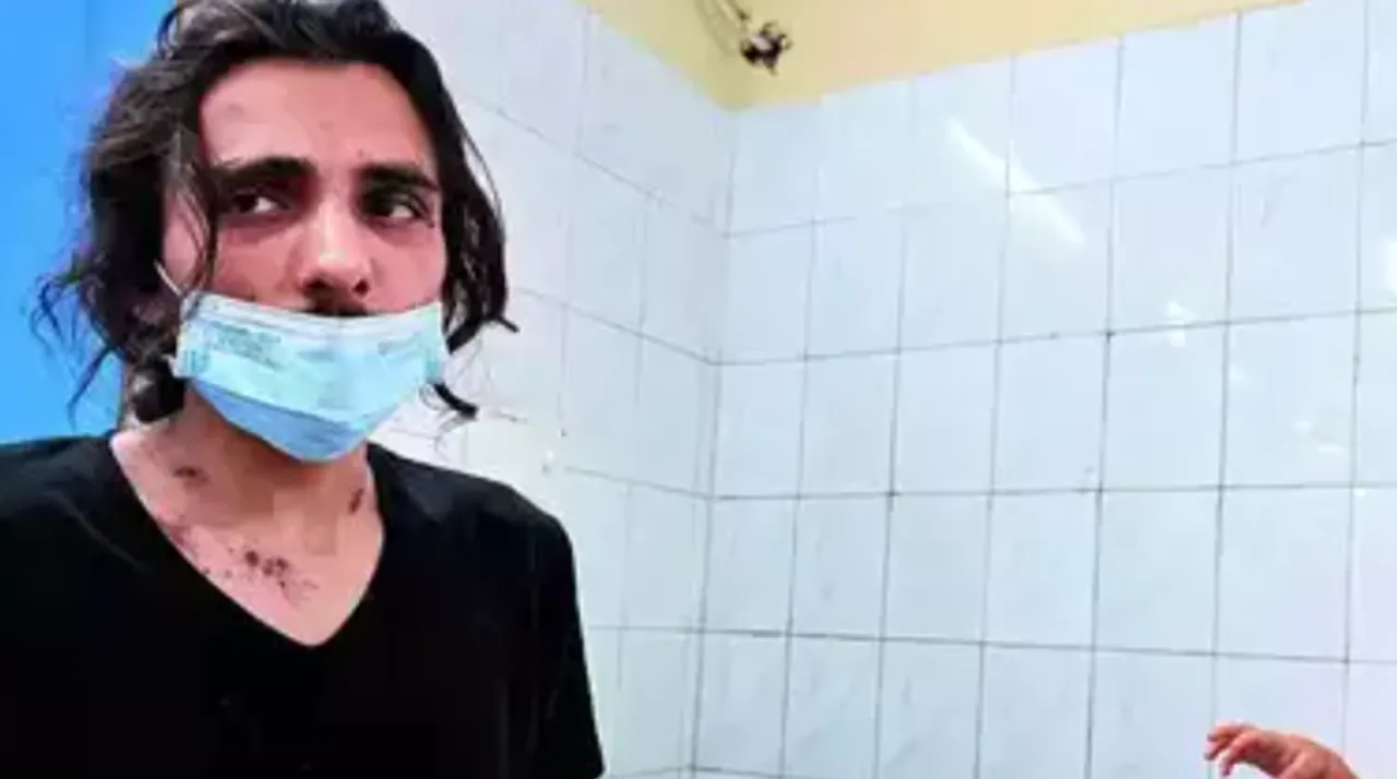  Acid attack on a Syrian refugee and his 11-month-old son