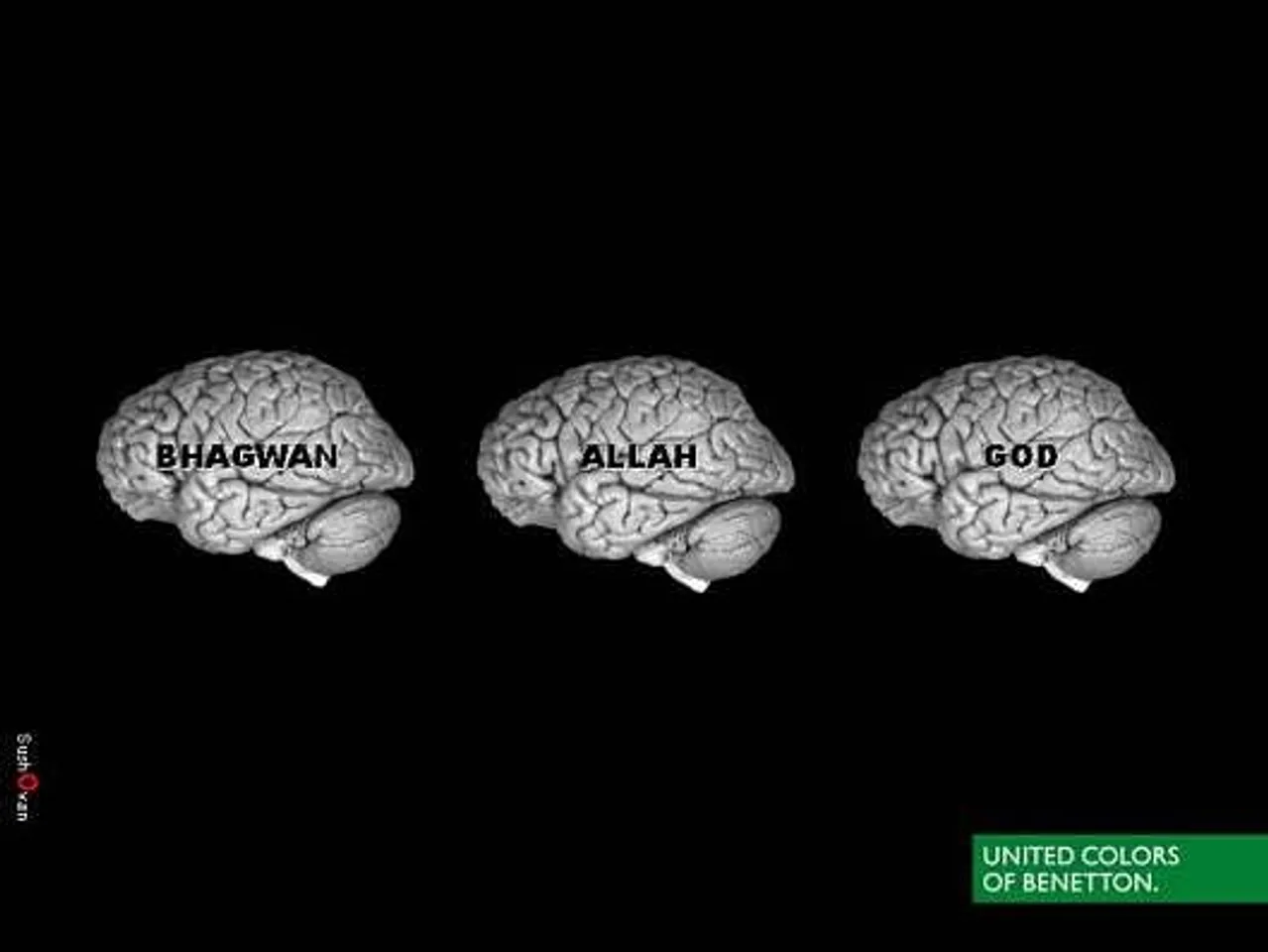 Brains