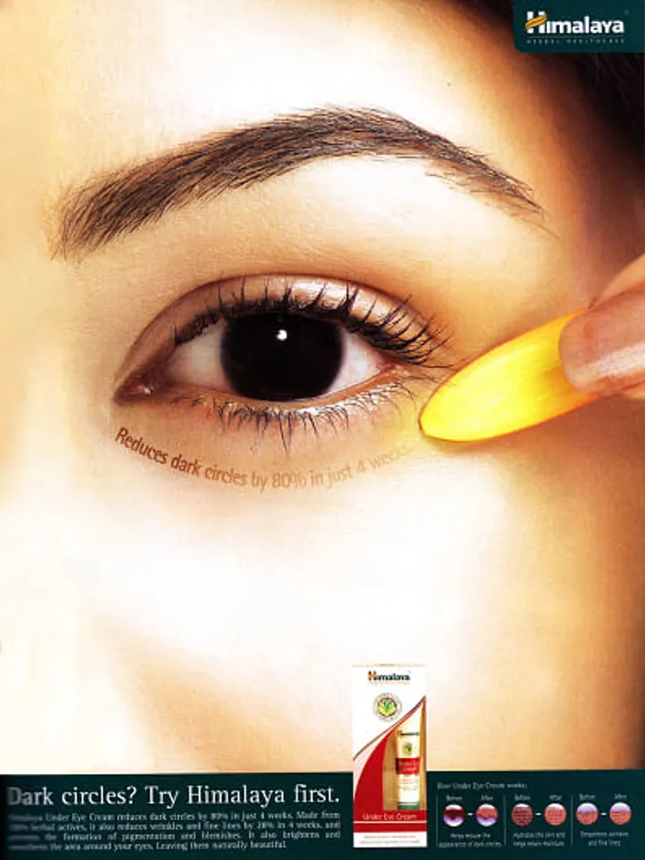 Dark circles