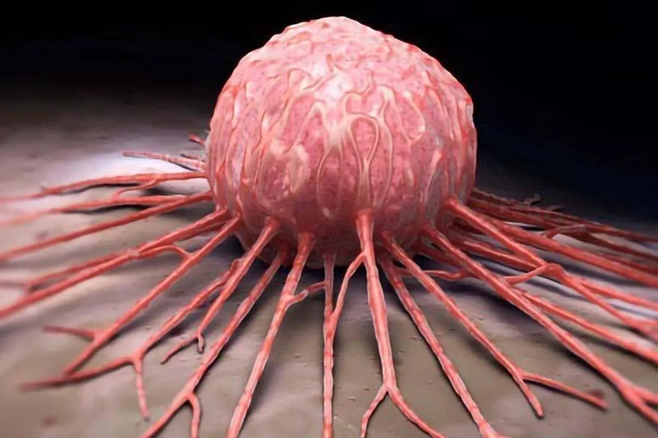 শিবপুরে মহিলার পেট থেকে বেরোল সাড়ে ৭ কেজি ওজনের টিউমার