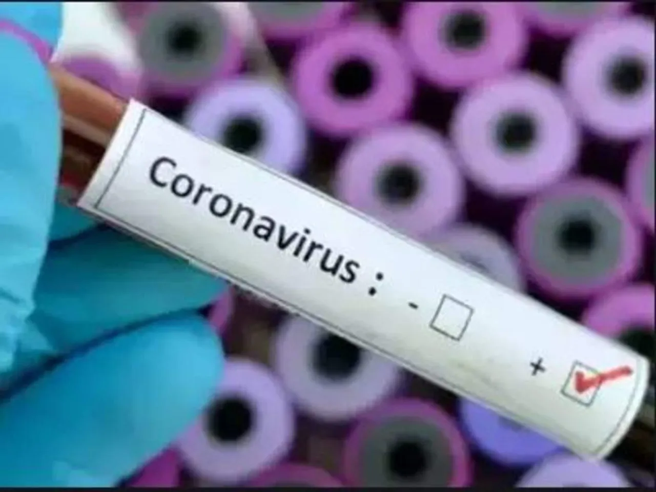 কলেজ খুলতেই বিপত্তি, করোনায় আক্রান্ত ১১ জন পড়ুয়া