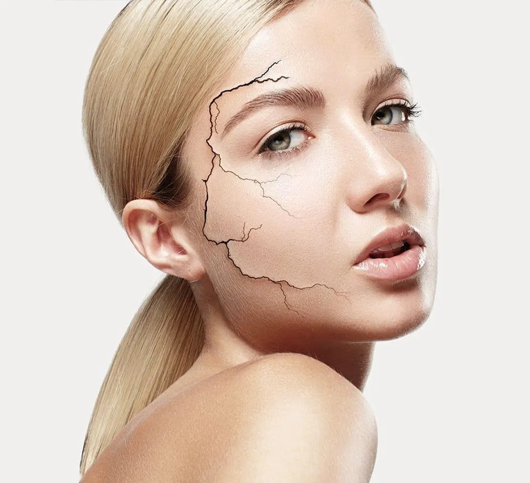 বর্ষাকালে নিষ্প্রাণ ত্বকে প্রান ফেরাতে মারাত্মক কার্যকরি এই দুটি উপাদান