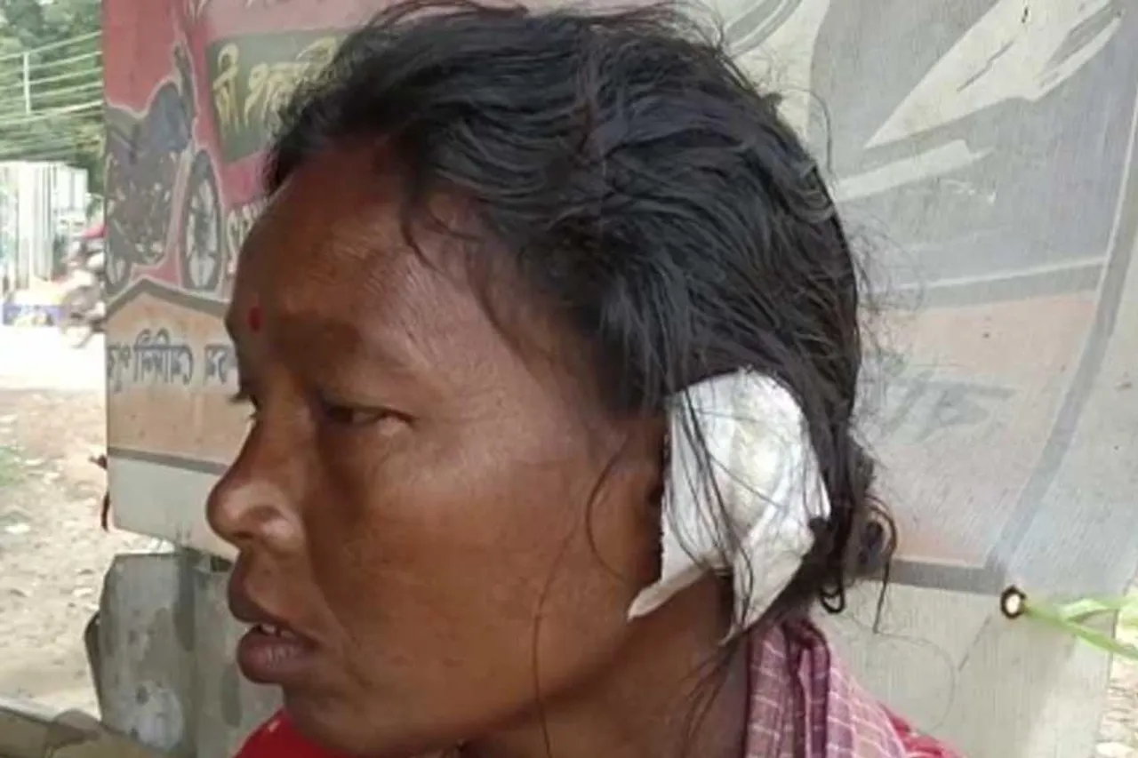 পারিবারিক বিবাদের জেরে মহিলার কান ছিঁড়লো আরেক মহিলা