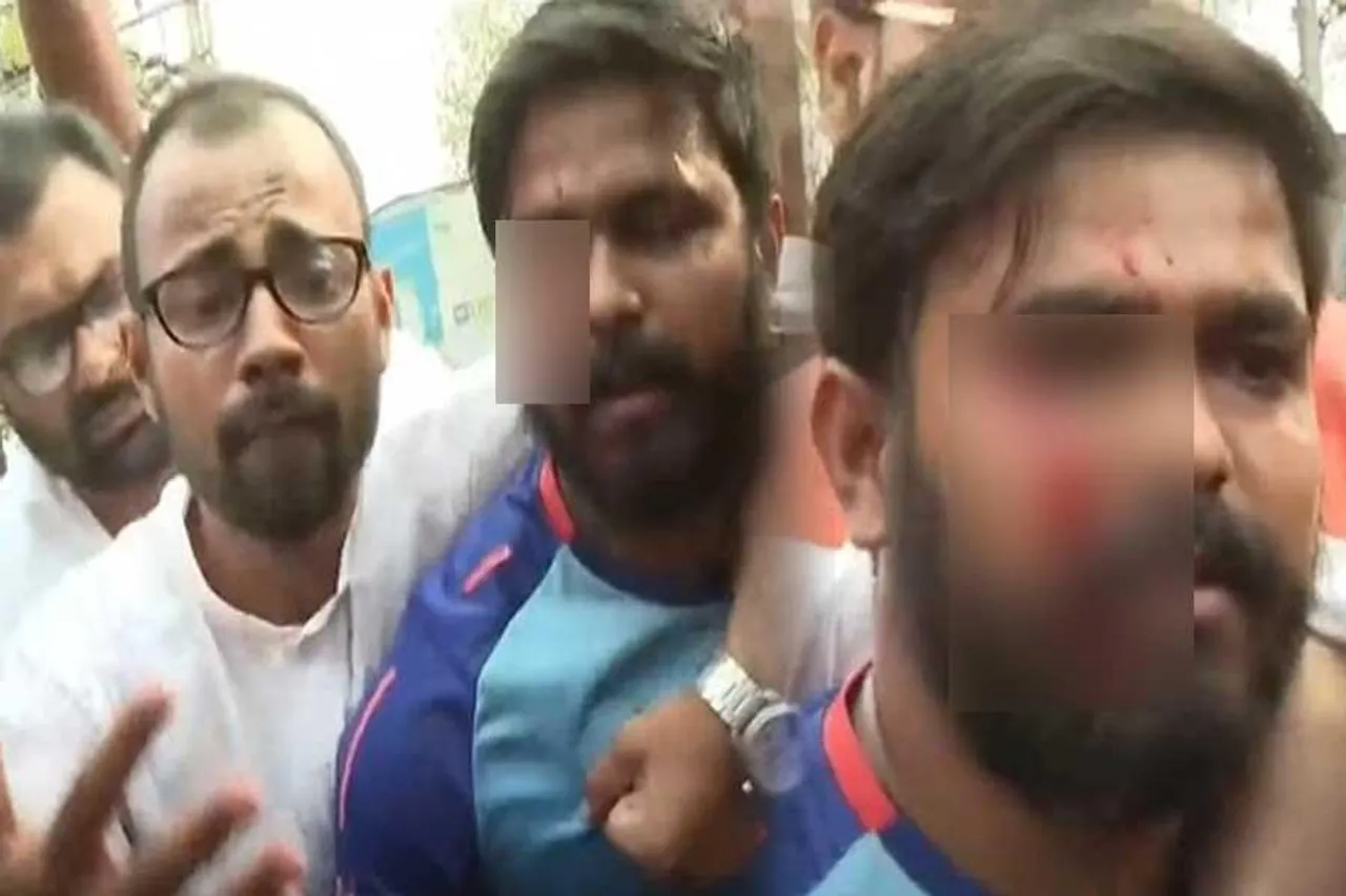 পুলিশের লাঠির আঘাতে মাথা ফাটল বিজেপি কর্মীর!