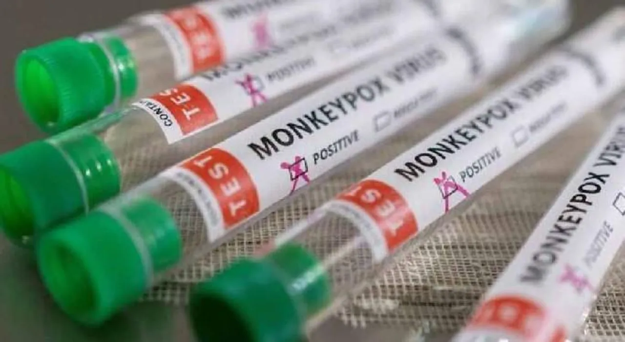 মাঙ্কি পক্স ভাইরাস সংক্রমণের আশঙ্কায় পাঁচ বছরের শিশুর নমুনা পরীক্ষা করা হল গাজিয়াবাদে