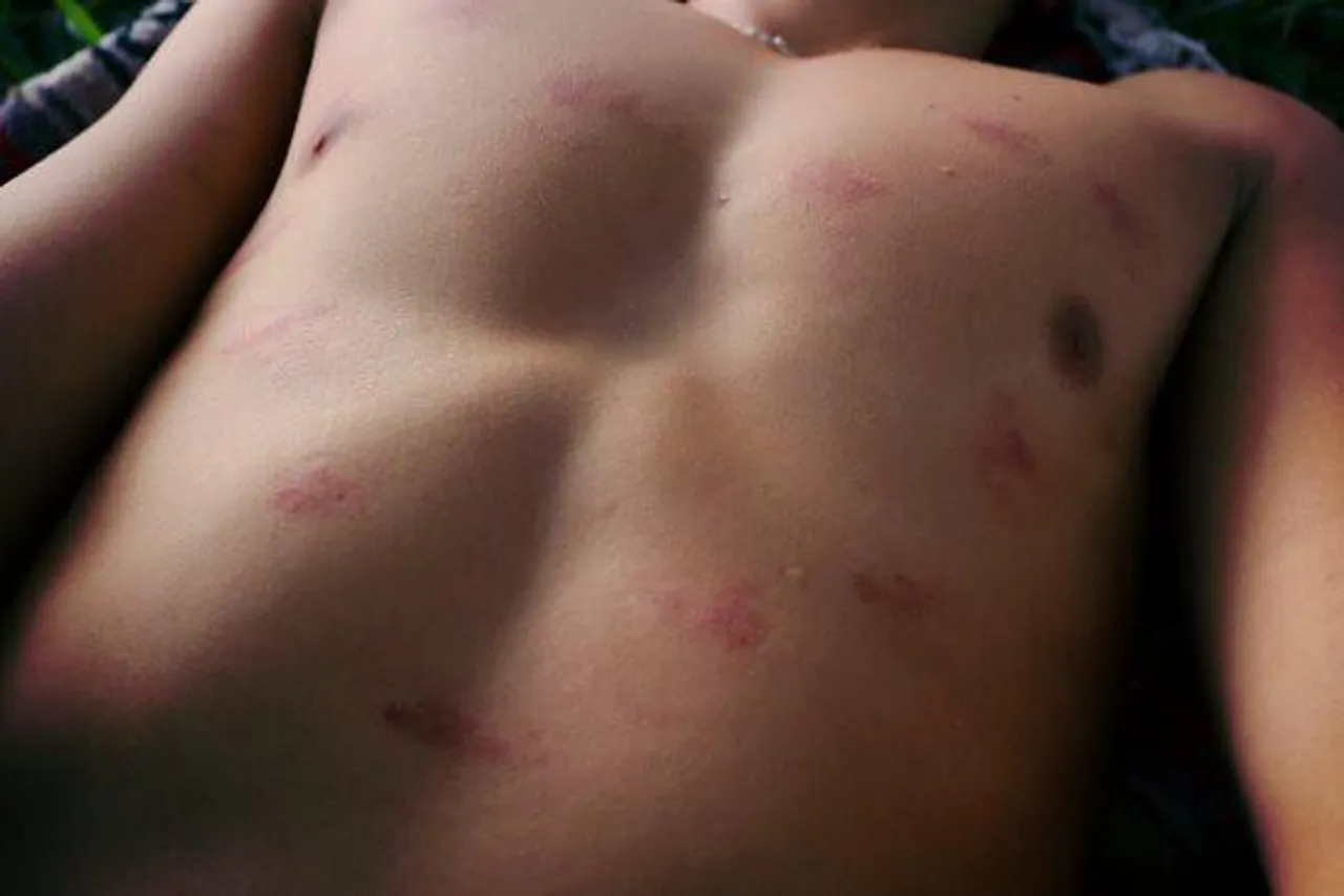 কামড় দিতে শিখুন