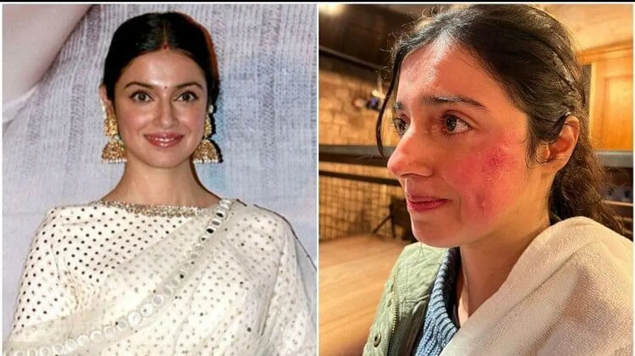 রক্তারক্তি কাণ্ড! আহত অভিনেত্রী