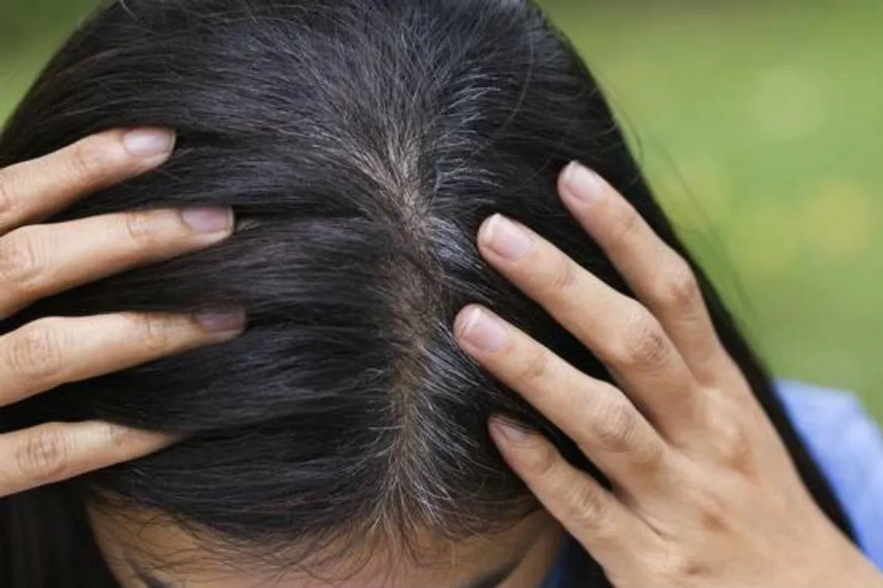 অকালে চুল পেকে যাচ্ছে?