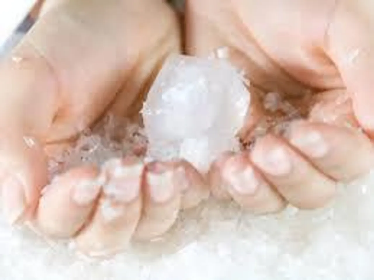 পোড়া স্থানে বরফ নয়!