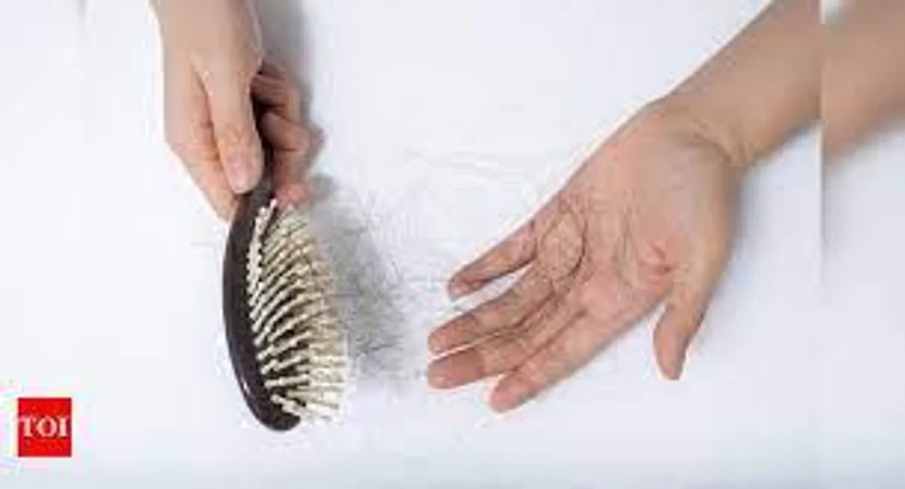 মিষ্টি বেশী খেলে টাক পড়ার সম্ভাবনা অল্প বয়সেই