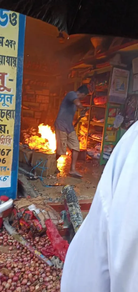 ডেবরায় দোকানে আগুন লাগায় গুরুতর আহত ২