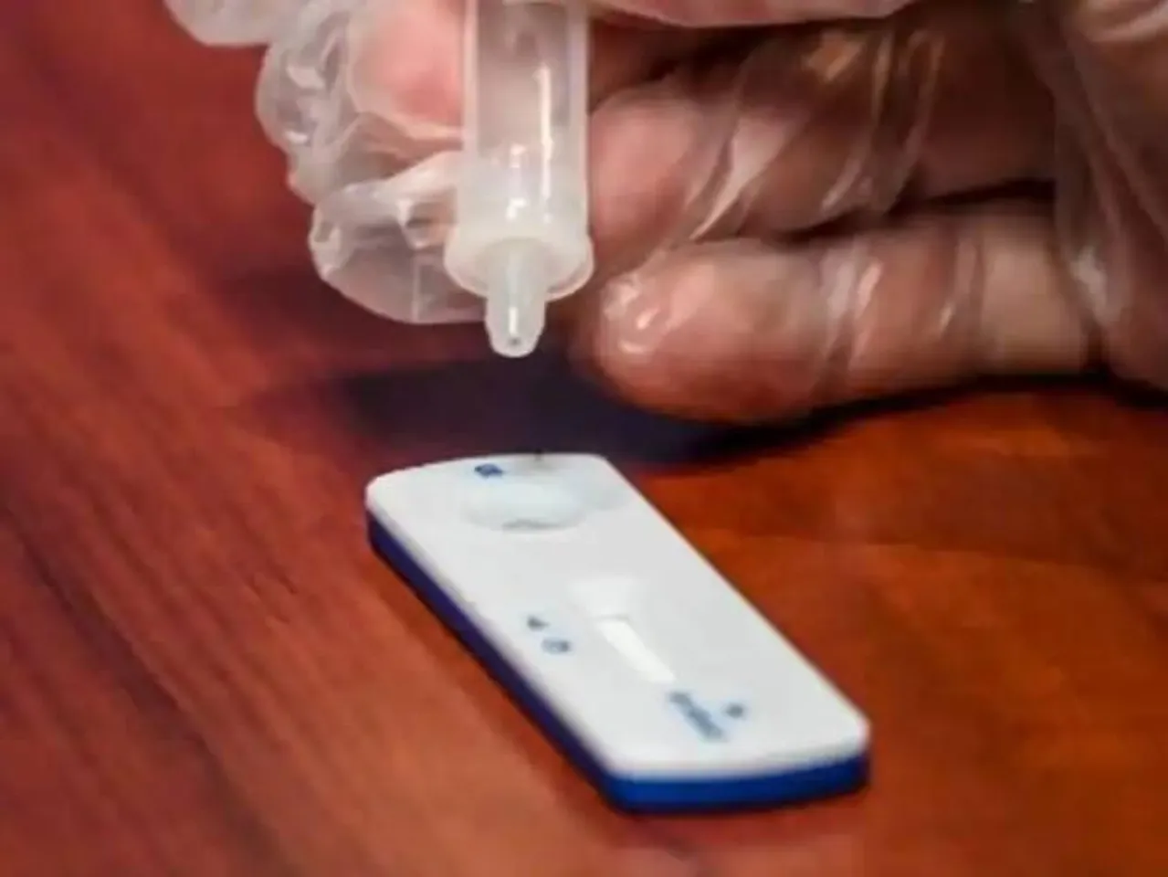 সরকারি কেন্দ্রে অ্যাডিনো টেস্ট কিটের সঙ্কট