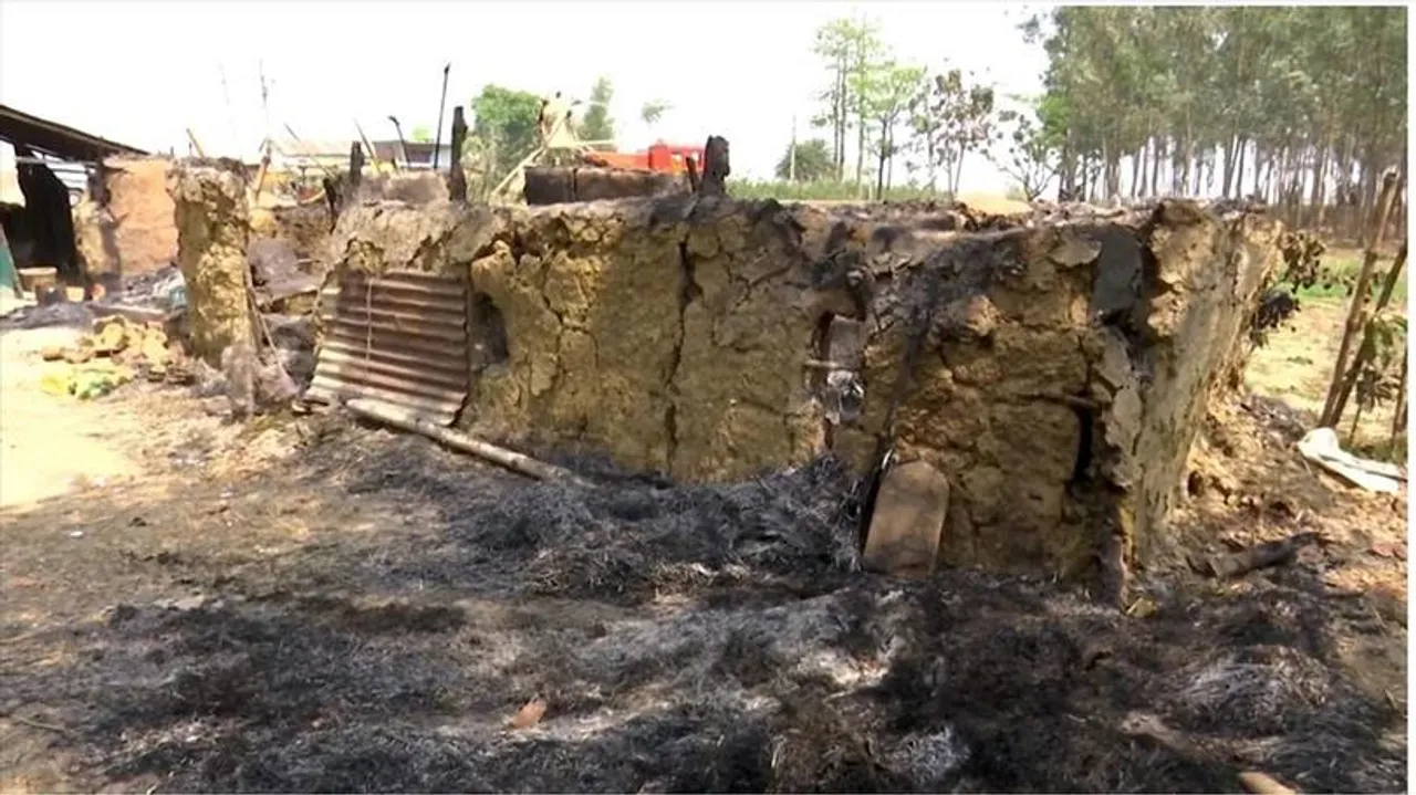 অগ্নিদগ্ধ নাজেমা বিবির শারীরিক অবস্থার অবনতি