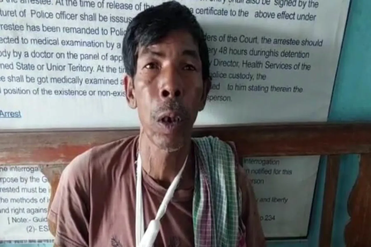 ডেবরায় মদ ব্যবসা করতে বারন করায় কাঠারির কোপ খেলেন এক ব্যাক্তি