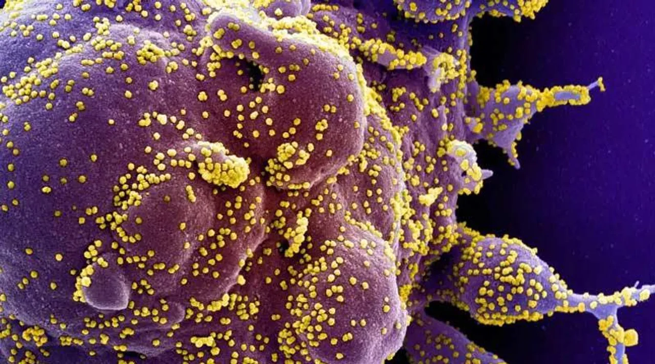 সাইপ্রাসে সন্ধান মিলল করোনার নয়া স্ট্রেন ডেল্টাক্রনের!