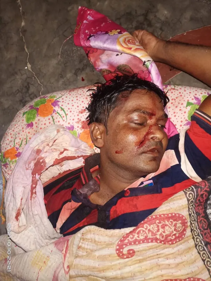 পঞ্চমীর রাতে দিনহাটায় রাজনৈতিক সংঘর্ষে বলি 2