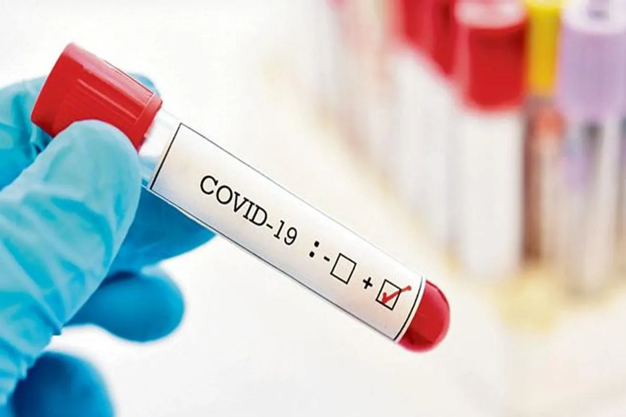 করোনায় আক্রান্ত প্রধানমন্ত্রী