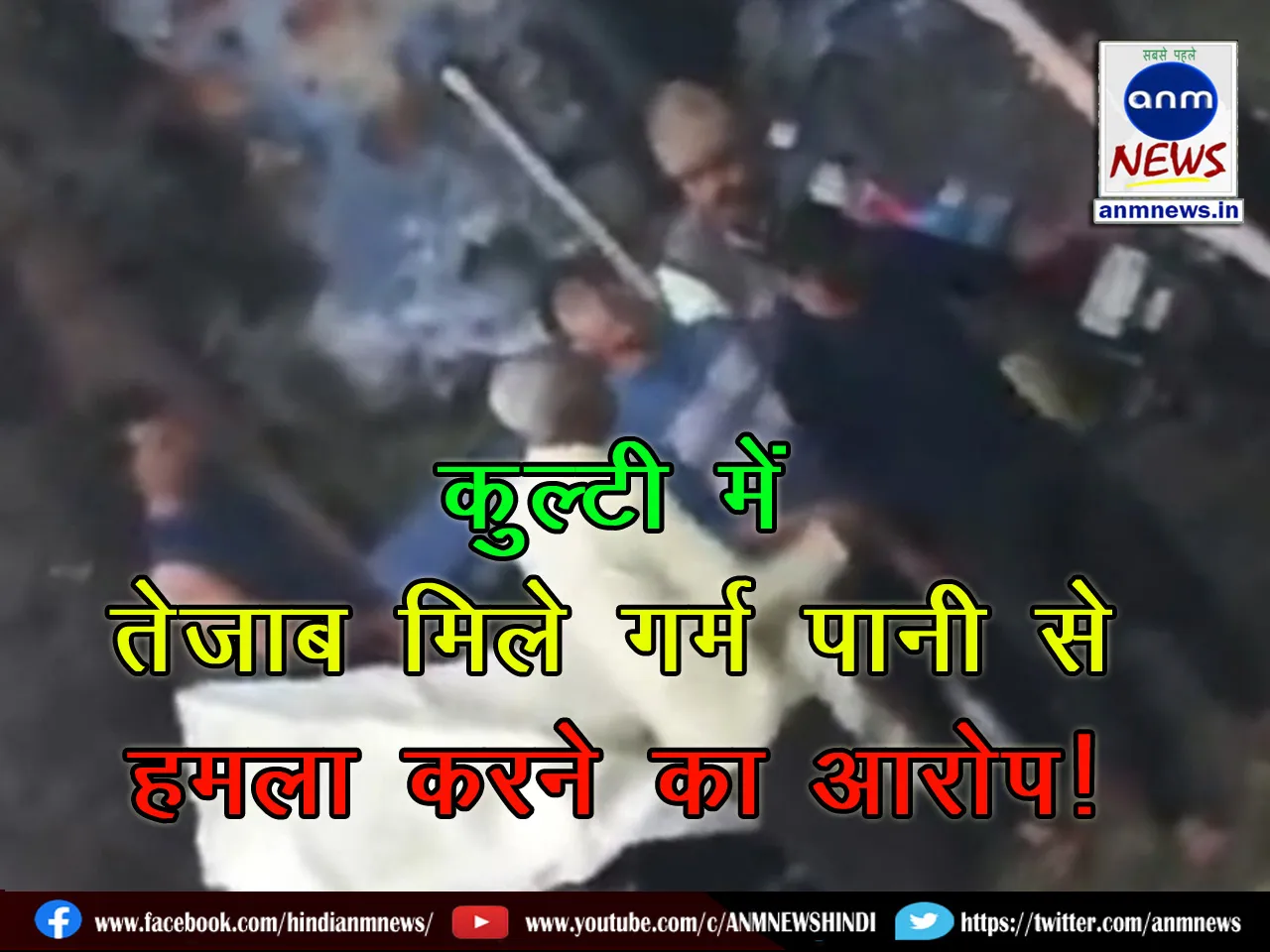 Alleged attack with hot water mixed with acid during a fight in Kulti