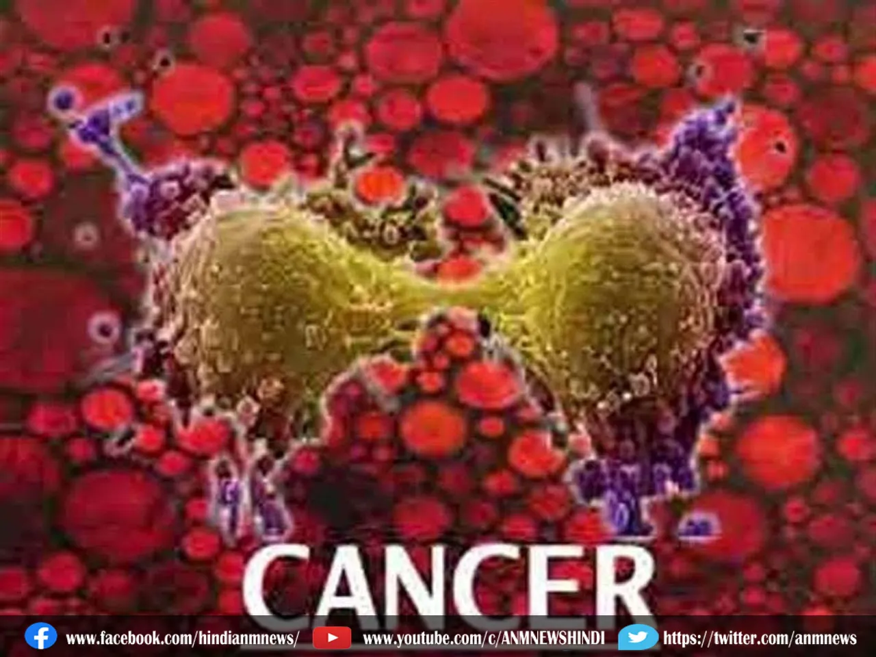 tumor cells