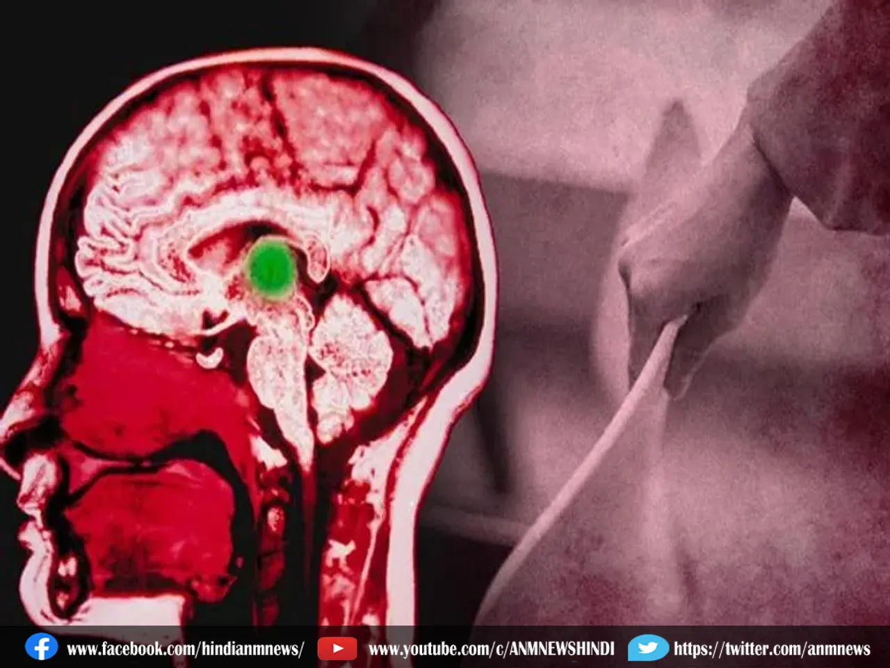 brain