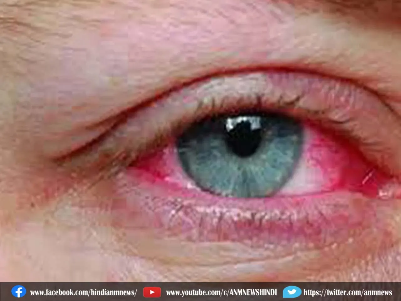 eyeflu67