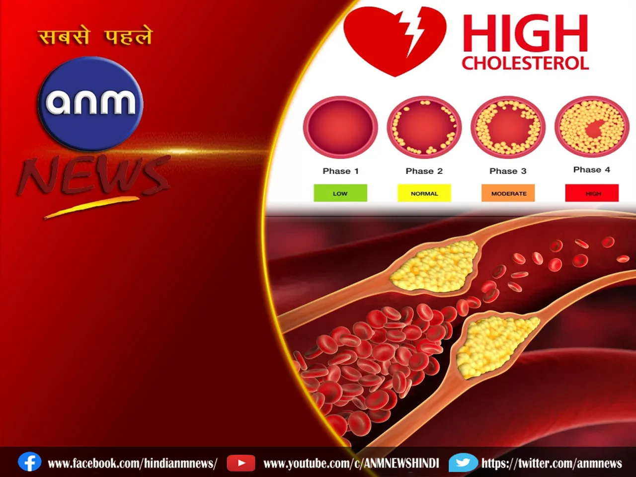 high cholesterol.