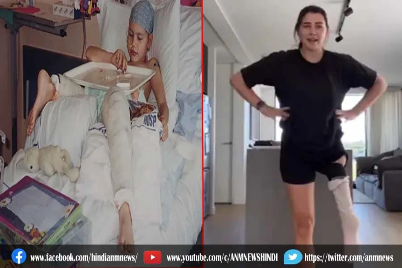 डॉक्टरों ने महिला के शरीर में लगा दिया उल्टा पैर