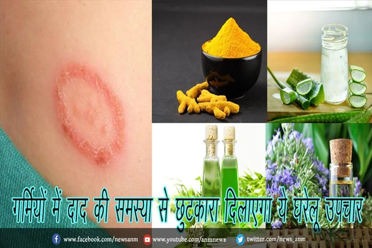 गर्मियों में दाद की समस्या से छुटकारा दिलाएगा ये घरेलू उपचार