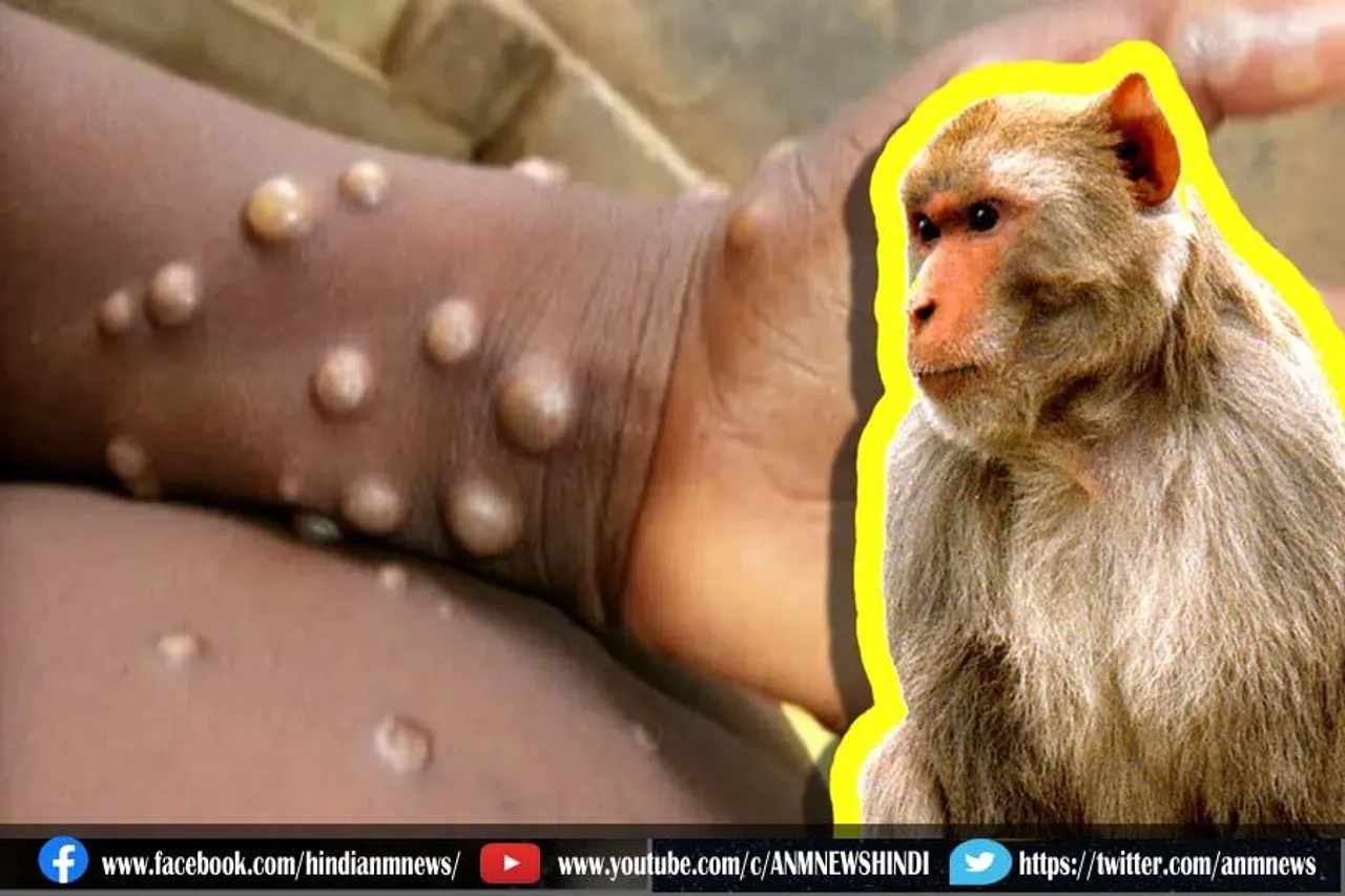 मंकीपॉक्स कैसे फैलता है?
