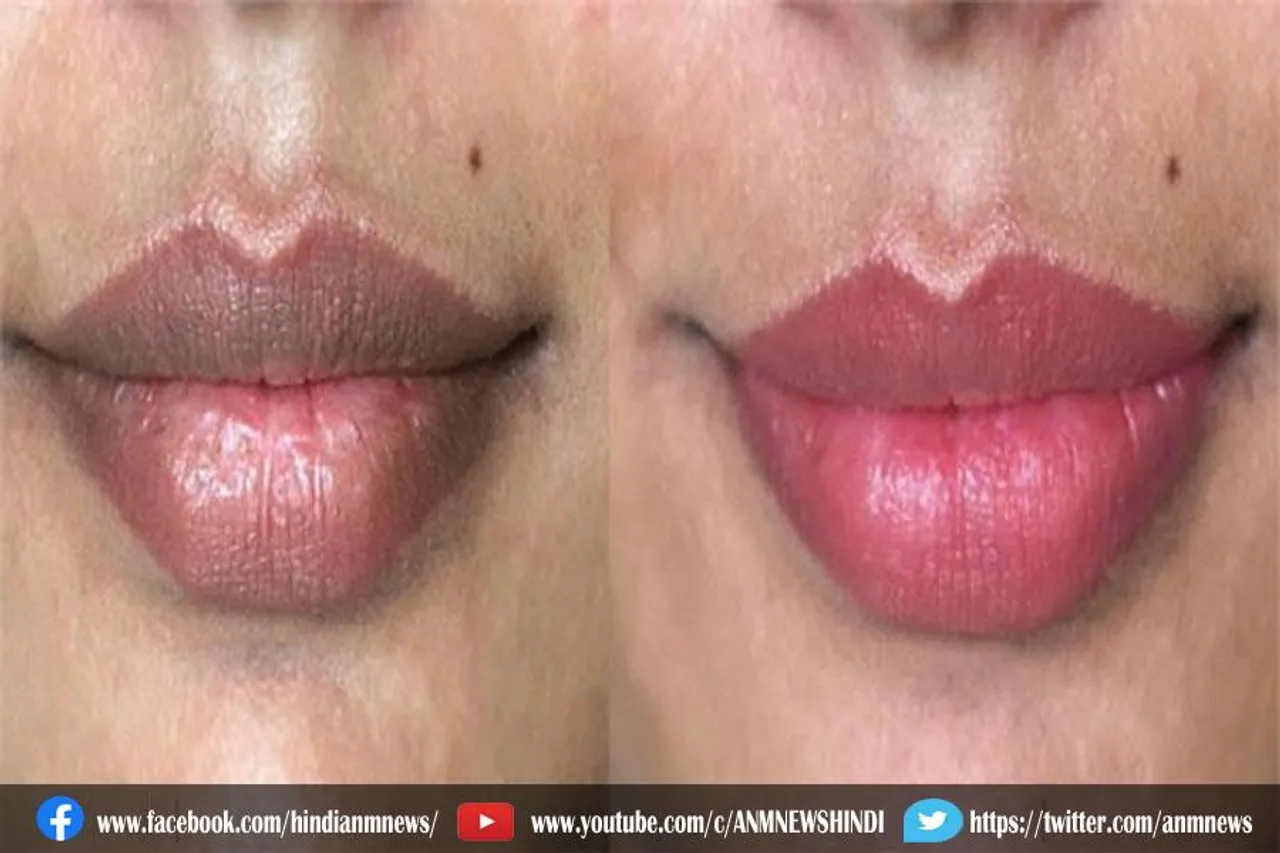 काले होठों को सही करने का घरेलू उपाय