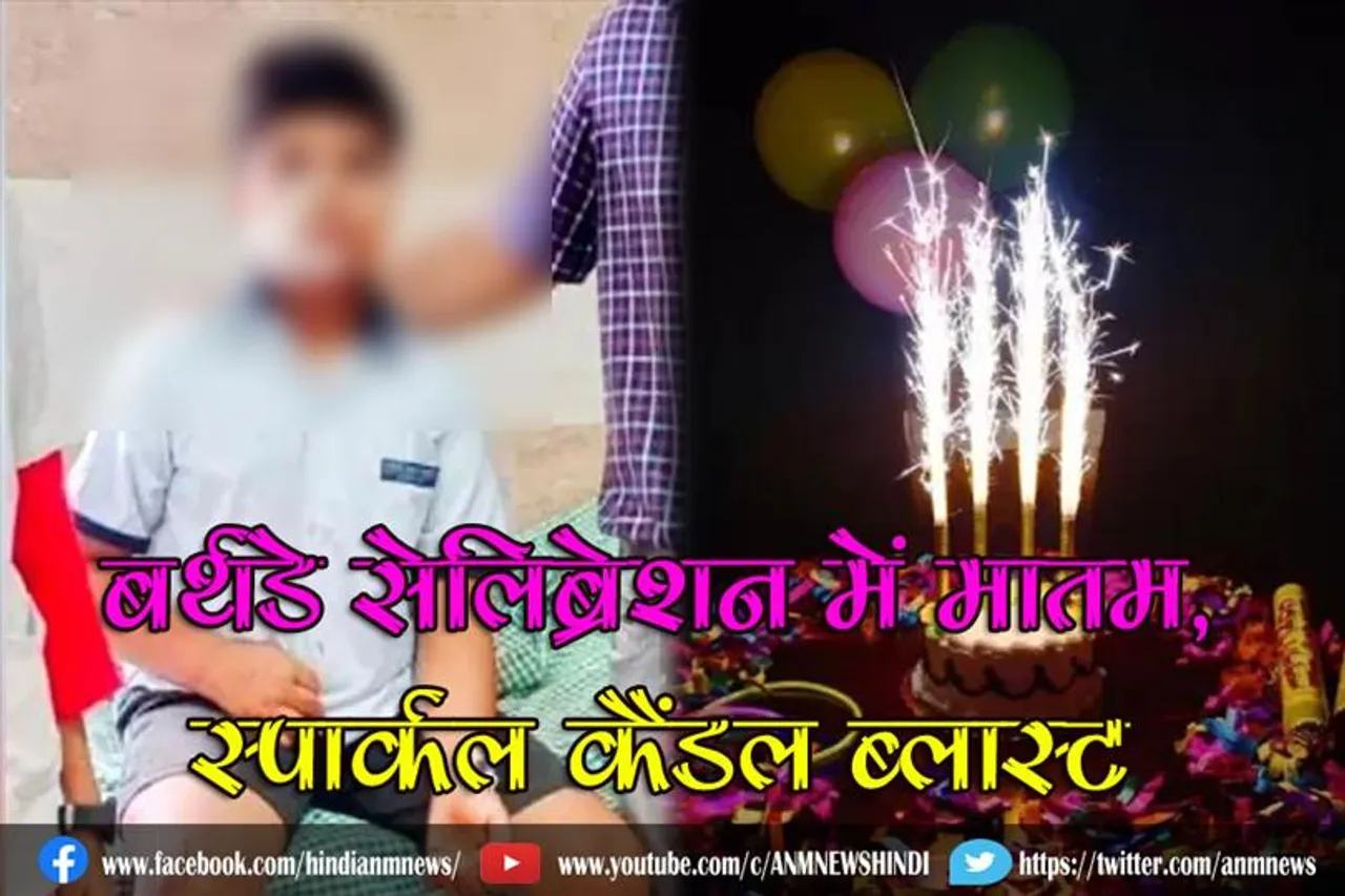बर्थडे सेलिब्रेशन में मातम, स्पार्कल कैंडल ब्लास्ट