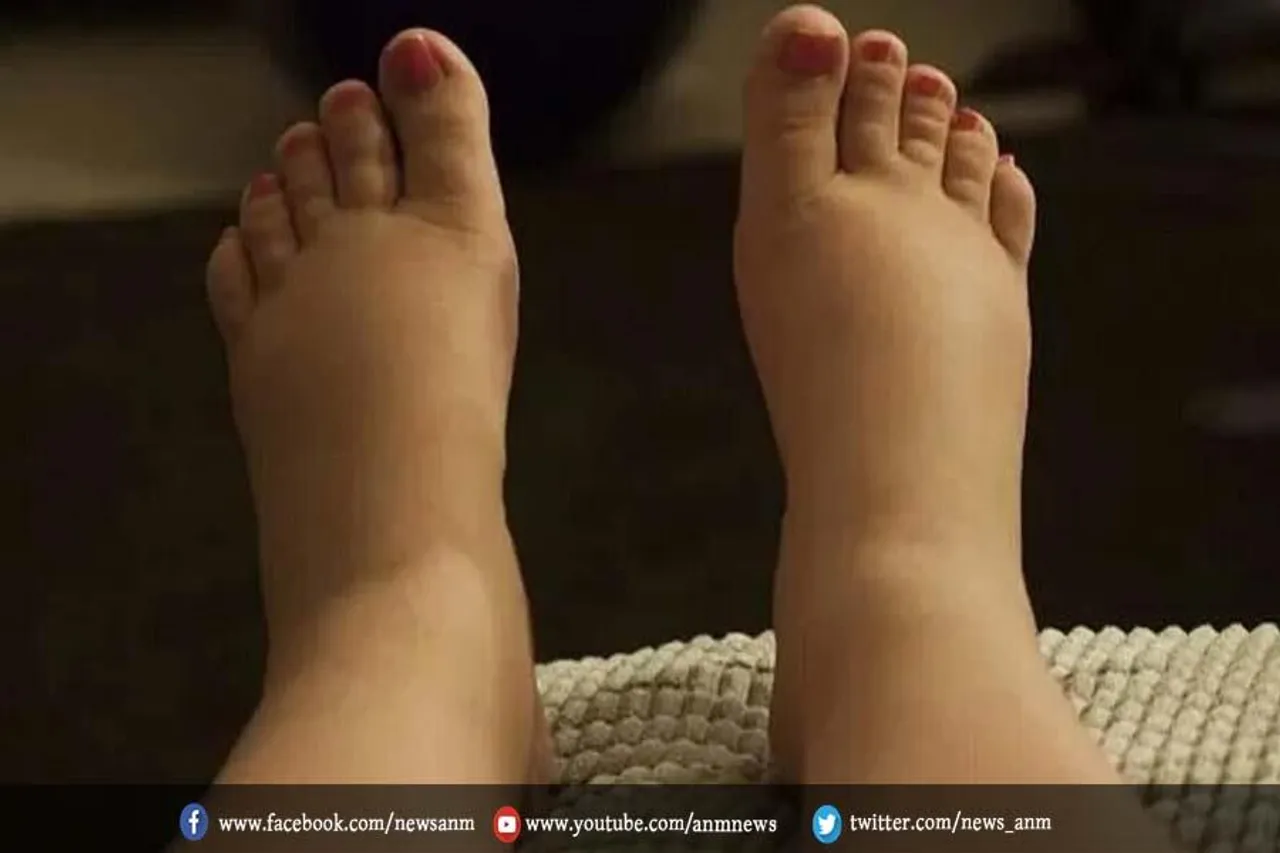 ज्यादा शुगर लेने पर शरीर में नजर आ सकते हैं ये बदलाव