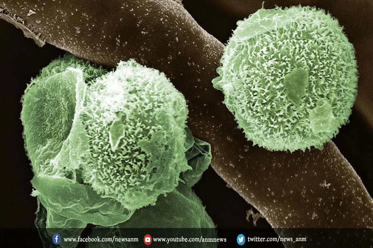 अब देश में ग्रीन फंगस ने दी दस्तक
