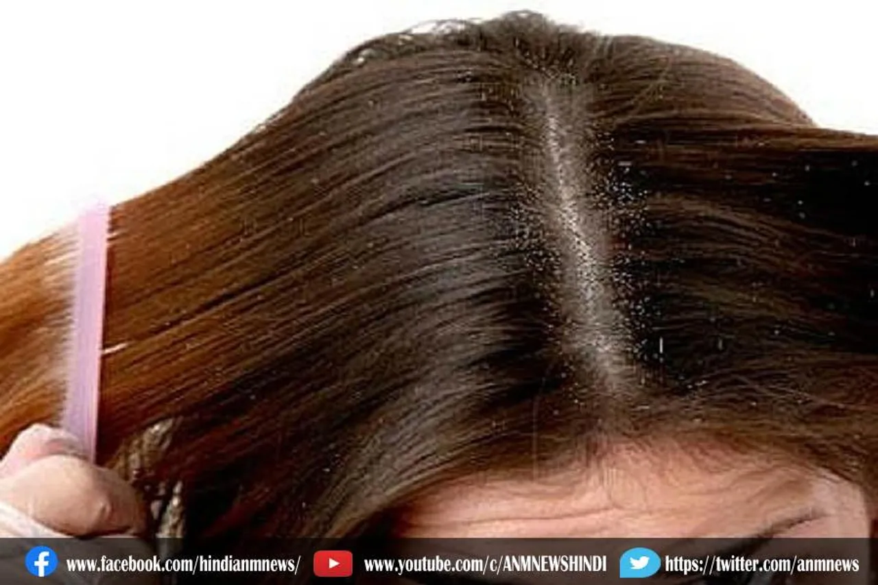 हेयर प्रॉब्लम्स को हमेशा के लिए कहे बॉय- बॉय